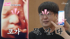 초음파 사진과 이렇게 똑같을 수 없다 화제의 남편 등장 TV CHOSUN 251021 방송 초음파 사진과 이렇게 똑같을 수 없다 화제의 남편 등장 TV CHOSUN 251021 방송