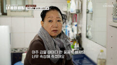 가속노화로 인해 탈모까지?! 모자 없이는 외출하기 힘들어하는 그녀 TV CHOSUN 251214 방송