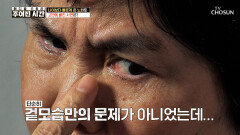 주름부터 체크하는 하루 급속도로 시작된 노화에 무너진 질병 도미노 TV CHOSUN 260509 방송