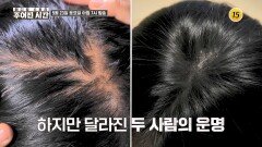 속수무책 탈모! 모발 건강을 사수하라_메디컬 스토리 주어진 시간 15회 예고 TV CHOSUN 260523 방송