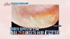 발뒤꿈치 각질 개선까지 도와주는 콜라겐 섭취 | JTBC 230126 방송