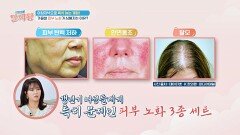 가을철 중년 여성들의 피부 노화가 심해지는 이유는 갱년기 때문?! | JTBC 241107 방송