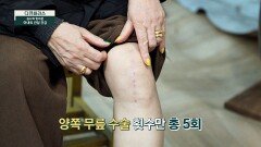 무릎 수술만 5번?! 일상을 괴롭히는 퇴행성 관절염 | JTBC 240121 방송