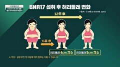 요요 없이 산후 비만 탈출! 다이어트의 핵심 → 다이어트 유산균 'BNR17' | JTBC 240623 방송