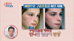 충격😱 비염으로 얼굴 변형까지 올 수 있다? (ft. 아데노이드 형 얼굴) | JTBC 210410 방송