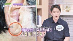 귓볼에 세로 주름이 있으면 치매 확률이 높다?! 진실입니다 | JTBC 241009 방송