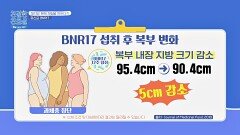 다이어트를 위한 트롯 가수 김양의 선택! 모유 유래 유산균 'BNR17' | JTBC 241111 방송