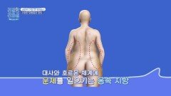 뇌경색의 주요 위험 인자 비만에서 시작되는 다양한 합병증들⁉️ | JTBC 260330 방송