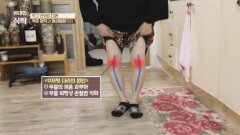 무릎 '퇴행성 관절염'때문에 휘고 변형된 다리... | JTBC 240323 방송