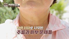 탄력 저하로 고통받고 있는 중년 여성 그녀의 안타까운 사연은? | JTBC 240615 방송