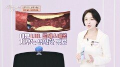 나쁜 중성지방 낮추고 착한 HDL은 증가↗ 혈관 걱정 덜어주는 '폴리코사놀' | JTBC 251228 방송