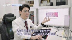 두피 열감, 지루성 두피염으로 탈모 가속화?! | JTBC 240415 방송