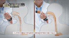 괴로운 비염에서 해방! '삼백초 추출물' 섭취 후 나타난 변화 | JTBC 251206 방송
