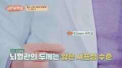 머릿속의 시한폭탄 '뇌혈관'🧠, 실제 크기는 | JTBC 260325 방송