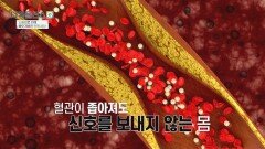 70%가 좁아질 때까지 증상이 없다?! 조용하게 치명적인 혈관 질환 | JTBC 260322 방송
