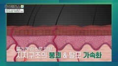 나이에 상관없이 다가오는 탈모의 공포 | JTBC 260510 방송