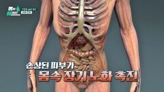 떨어진 피부 탄력, 단지 미용의 문제가 아니다! '이것'까지 올 수 있다고 | JTBC 260302 방송