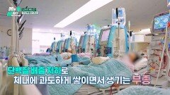 우리가 대수롭게 생각하지 않은 부종, '사망'까지 초래하는 위험 신호가 될 수 있다! | JTBC 260309 방송