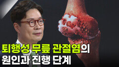 왕준호 교수, 건강하게 걷자! 퇴행성 무릎 관절염 | KBS 251113 방송 