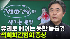 김유진 교수, 똑바로 어깨를 펴자! 석회화건염 | KBS 251113 방송 