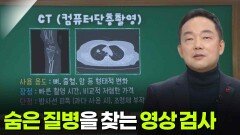 김영환 핵의학과 교수, 숨은 질병을 찾는 영상 검사 | KBS 251204 방송 