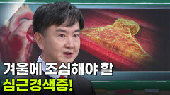 이상철 순환기내과 교수, 예고 없이 찾아오는 심근경색증?! | KBS 251218 방송 