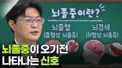 송태진 신경과 교수, ‘뇌졸중’이 오기 전 나타나는 신호 | KBS 260212 방송 