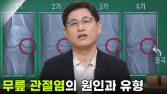 김영모 정형외과 교수, 일상을 힘들게 하는 ‘무릎 관절염’ | KBS 260305 방송 