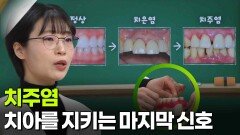 조영단 치주과 교수, 치아를 지키는 마지막 신호 ‘치주염’ | KBS 260312 방송 