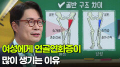 왕준호 정형외과 교수, 여성을 괴롭히는 무릎 통증 ‘연골연화증’ | KBS 260319 방송 