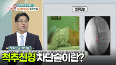 [닥터의 경고] 시간이 갈수록 심해지는 통증, 수술이 아닌 다른 치료 방법이 있을까? | KBS 251020 방송 