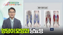 [무엇이든 팩트체크] 엉덩이 모양만 봐도 당뇨병 위험 알 수 있다? | KBS 251205 방송 