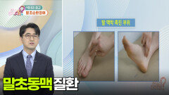 [닥터의 경고] 다리가 저리고 아파요! | KBS 251215 방송 
