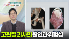 장수로 가는 생명축! 고관절을 지켜라! | KBS 260219 방송 
