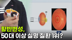 [닥터의 경고] 50대 이상 실명 질환 1위 황반변성? 혈압과 안압도 조기 진단 하세요! (황반변성, 녹내장) | KBS 260316 방송 