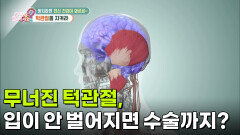 [백년습관] 무너진 턱관절, 입이 안 벌어지면 수술까지? | KBS 260325 방송 