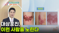 대상포진, 이런 사람을 노린다 | KBS 260514 방송 