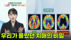 치매는 어느 날 갑자기 오지 않는다? 우리가 몰랐던 치매의 비밀 | KBS 260521 방송 