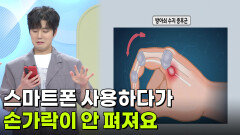 스마트폰 사용하다가 손가락이 구부러진 채로 잘 안 펴져요 | KBS 260618 방송 