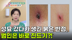 [의학 팩트체크] 성묘 갔다가 생긴 붉은 반점, 범인은 바로 진드기?! | KBS 260921 방송 