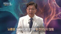 뇌종양 알면 극복한다! “ 뇌에서 다른 장기로 잘 전이되지 않음 ” | KBS 241120 방송