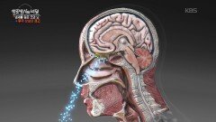 코로나 팬데믹과 고령화, 늘어나는 후각장애 | KBS 251105 방송 