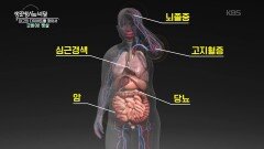 내 몸의 시한폭탄 뱃살, 연말연시가 골든타임! | KBS 251231 방송 