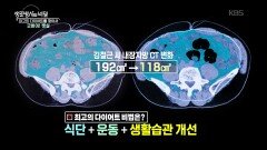 같은 뱃살, 다른 선택! 과연 4주 프로젝트의 결과는? | KBS 251231 방송 