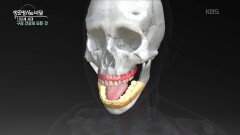 임플란트와 자석의 만남, 피개의치 | KBS 260211 방송 