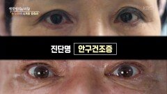 무심코 이어왔던 습관, 사실은 눈을 늙게 하는 주범이었다? -‘안구건조증’과 ‘스마트폰’ | KBS 260401 방송 