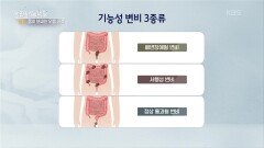 나는 어떤 변비일까? 기능성 변비 3종과 진단법! | KBS 260415 방송 