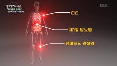 과해도 무너진다? 운동과 식단의 두 얼굴 | KBS 260527 방송 