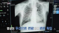 빠르고 편리하게 흉부 촬영이 가능한 이동형 엑스레이! | KBS 201101 방송