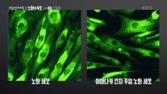세포의 운명을 바꿔 역노화로, 세포 리프로그래밍 | KBS 250424 방송 